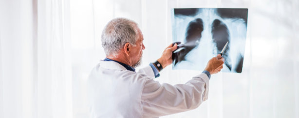 A doctor holds up and examines a chest X-ray in a brightly lit room.